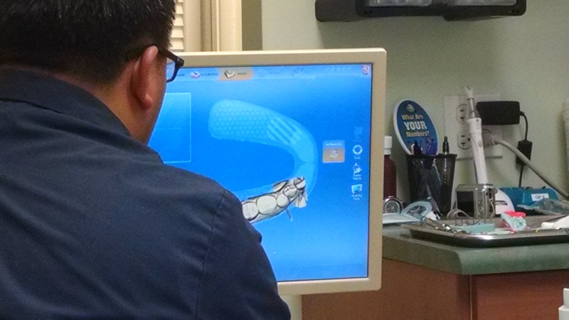 Don never got out of the chair and the whole process only took a couple of hours instead of days or weeks.