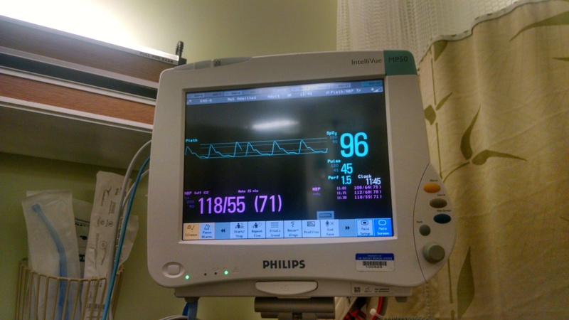Next he had a colonoscopy since we figured he had polyps because of Acromegaly. Yep, they took out 30+ of them. The alarm kept going off because his heart rate was between 40 and 45 beats per minute, which was lower than they expected.