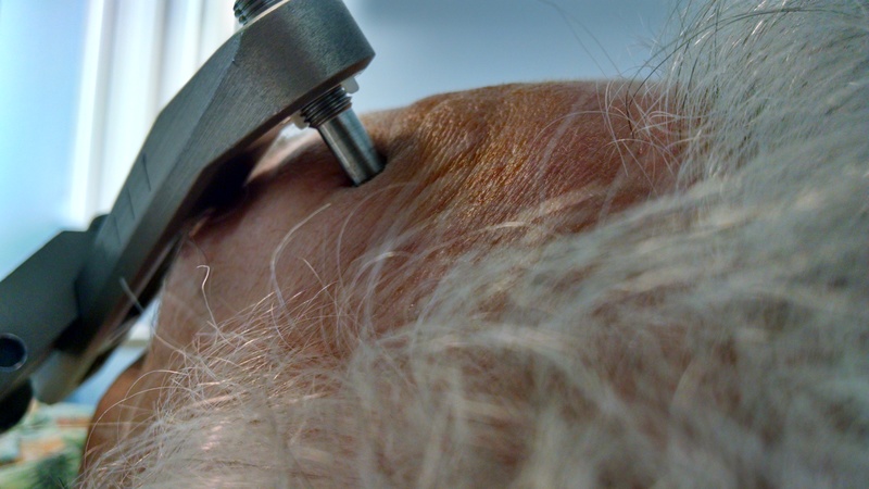 Closeup of the left bolt.